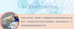 宁夏怀孕亲子鉴定准确性高吗在线咨询